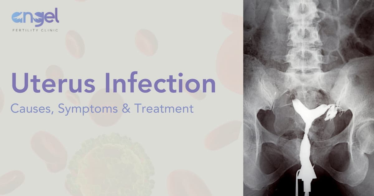 Uterus Infection: Causes, Symptoms & Treatment